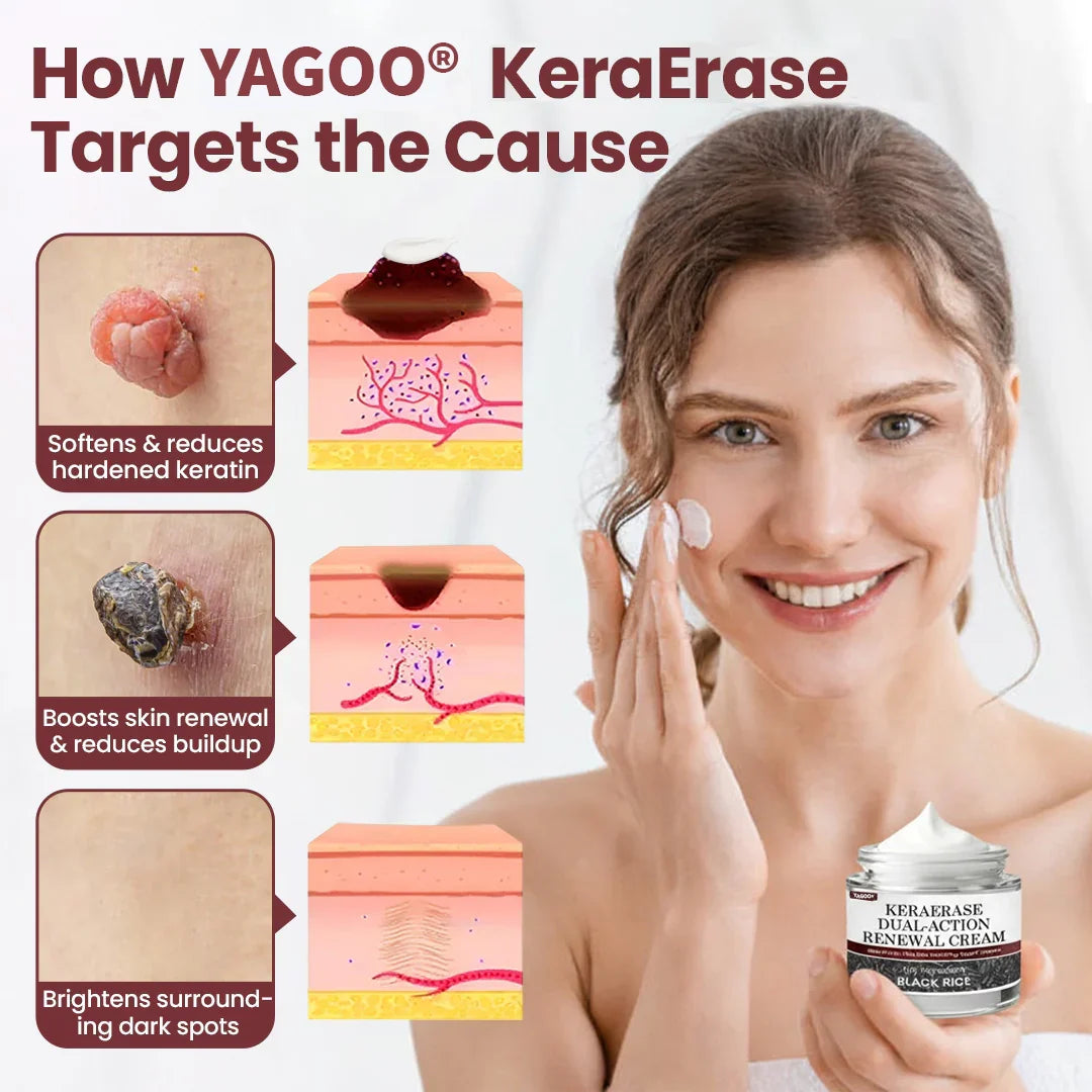 YAGOO® KeraErase Dual-Action Renewal Cream