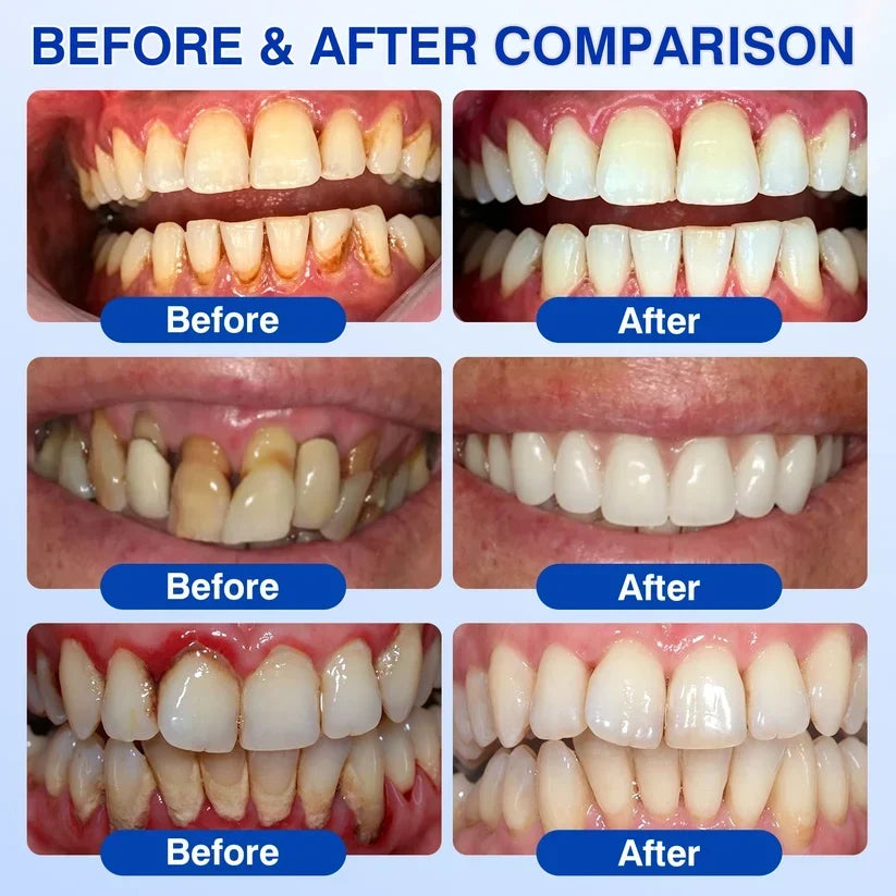 🏆🦷✨Tiworld® Gum health  Periodontal Repair Gel