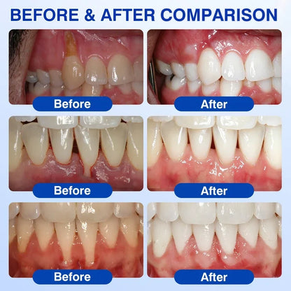 🏆🦷✨Tiworld® Gum health  Periodontal Repair Gel
