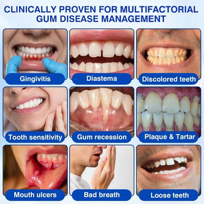 🏆🦷✨Tiworld® Gum health  Periodontal Repair Gel
