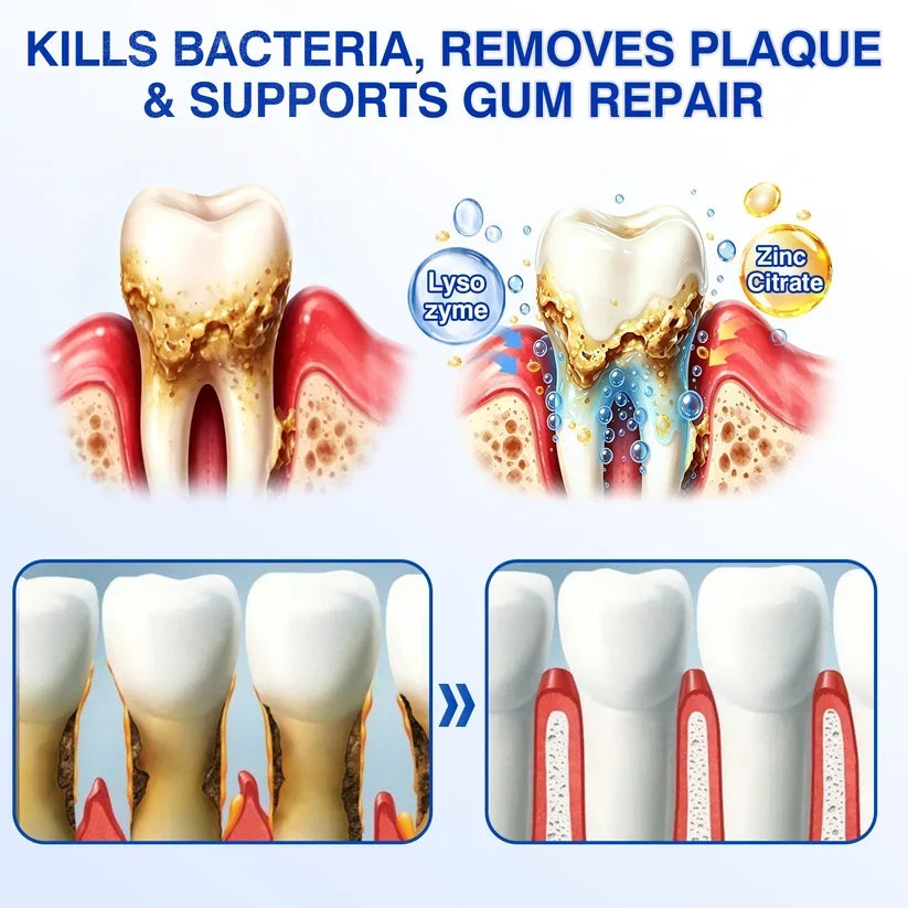 🏆🦷✨Tiworld® Gum health  Periodontal Repair Gel
