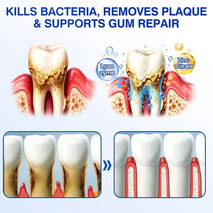 🏆🦷✨Tiworld® Gum health  Periodontal Repair Gel