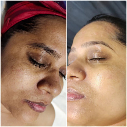 (🔥LAST DAY SALE-70% OFF)-Fast Dark Spot Remover-Tiworld™  Turmeric Spot Repair Serum