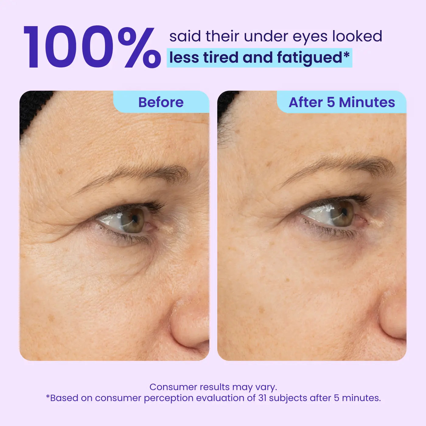 Final Hours: 60% OFF 🔥 SEAGRIL™ Instant Lift Eye Gel for Puffiness, Bags & Dark Circles