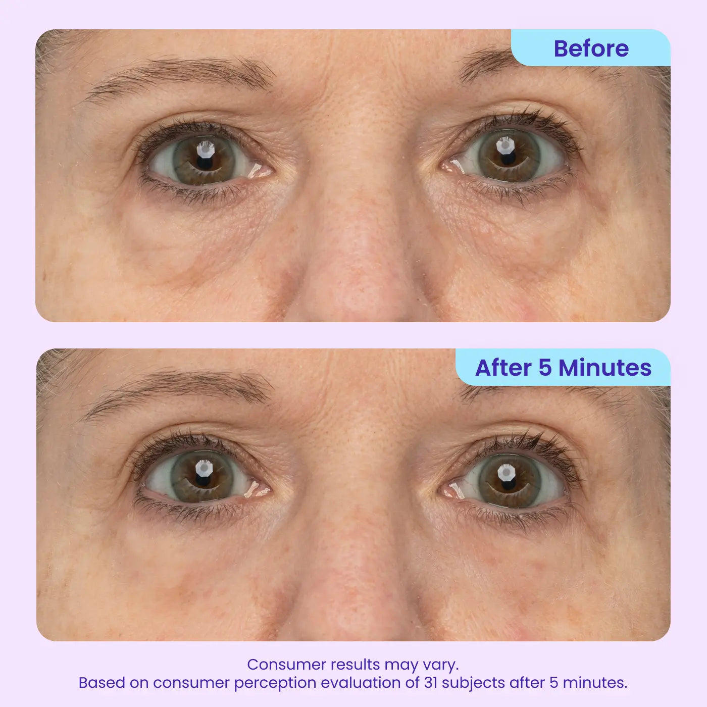 Final Hours: 60% OFF 🔥 SEAGRIL™ Instant Lift Eye Gel for Puffiness, Bags & Dark Circles