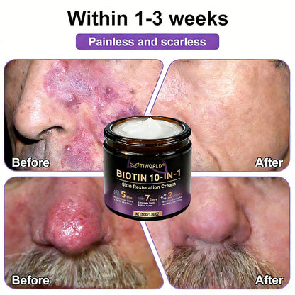 Made and Shipped from USA ✨TIWORLD® Biotin 10-in-1 Skin Restoration Cream 🍀