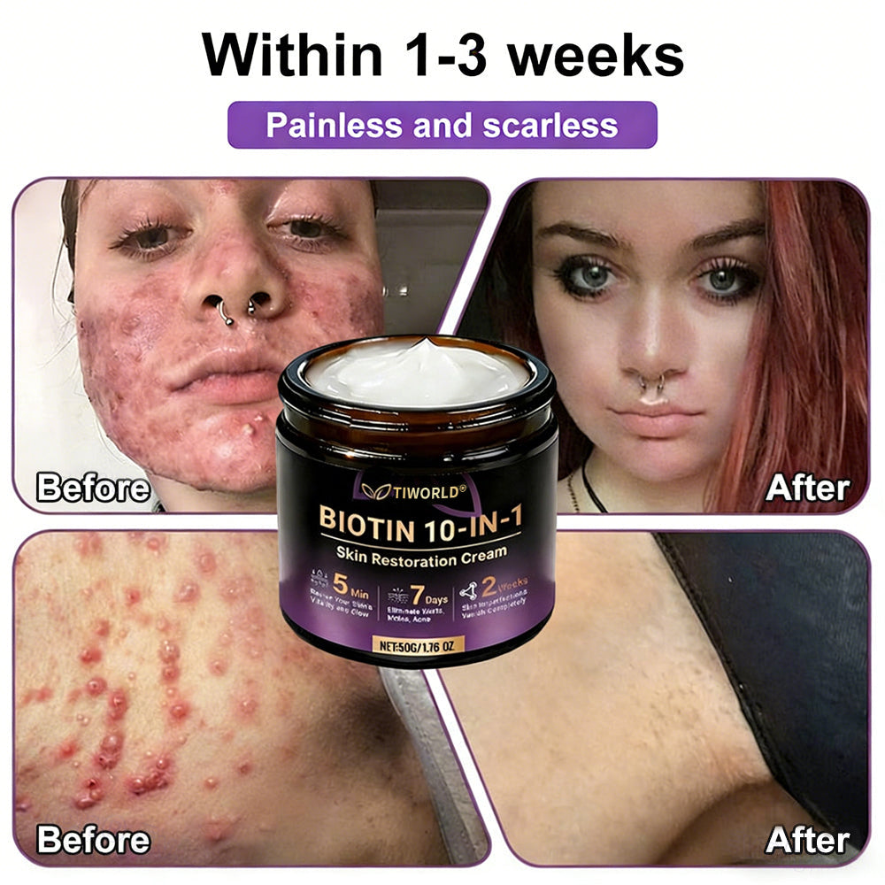 Made and Shipped from USA ✨TIWORLD® Biotin 10-in-1 Skin Restoration Cream 🍀