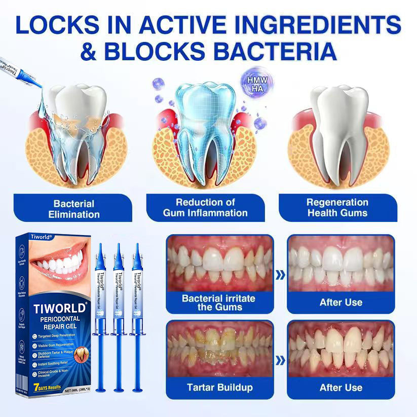 🏆🦷✨Tiworld® Gum health  Periodontal Repair Gel