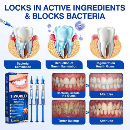 🏆🦷✨Tiworld® Gum health  Periodontal Repair Gel