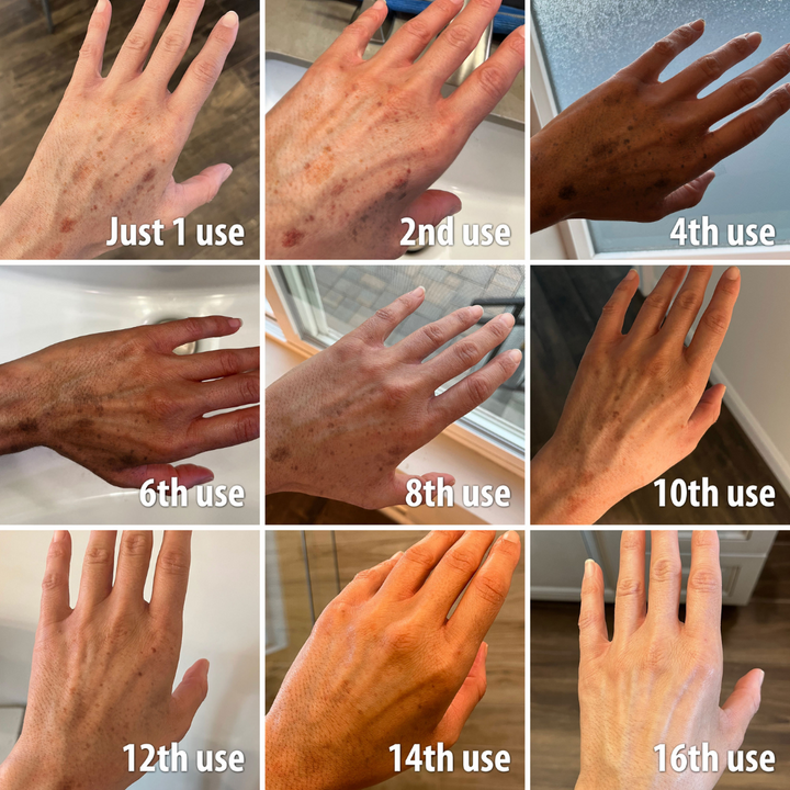 (🔥LAST DAY SALE-70% OFF)-Fast Dark Spot Remover-Tiworld™  Turmeric Spot Repair Serum