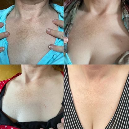 (🔥LAST DAY SALE-70% OFF)-Fast Dark Spot Remover-Tiworld™  Turmeric Spot Repair Serum