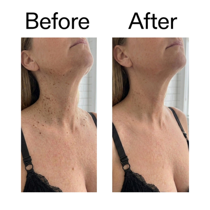 Smooth & Even Glycolic Body Stick