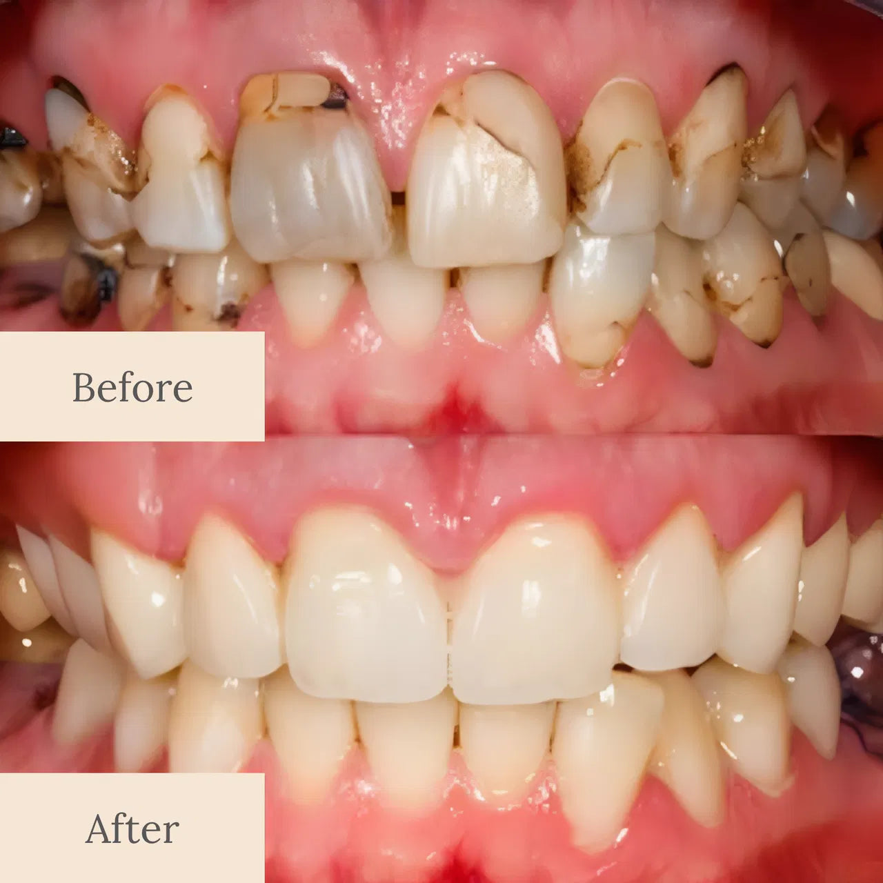 YAGOO® Nano-Hydroxyapatite Deep-Fusion Drops Advanced Enamel