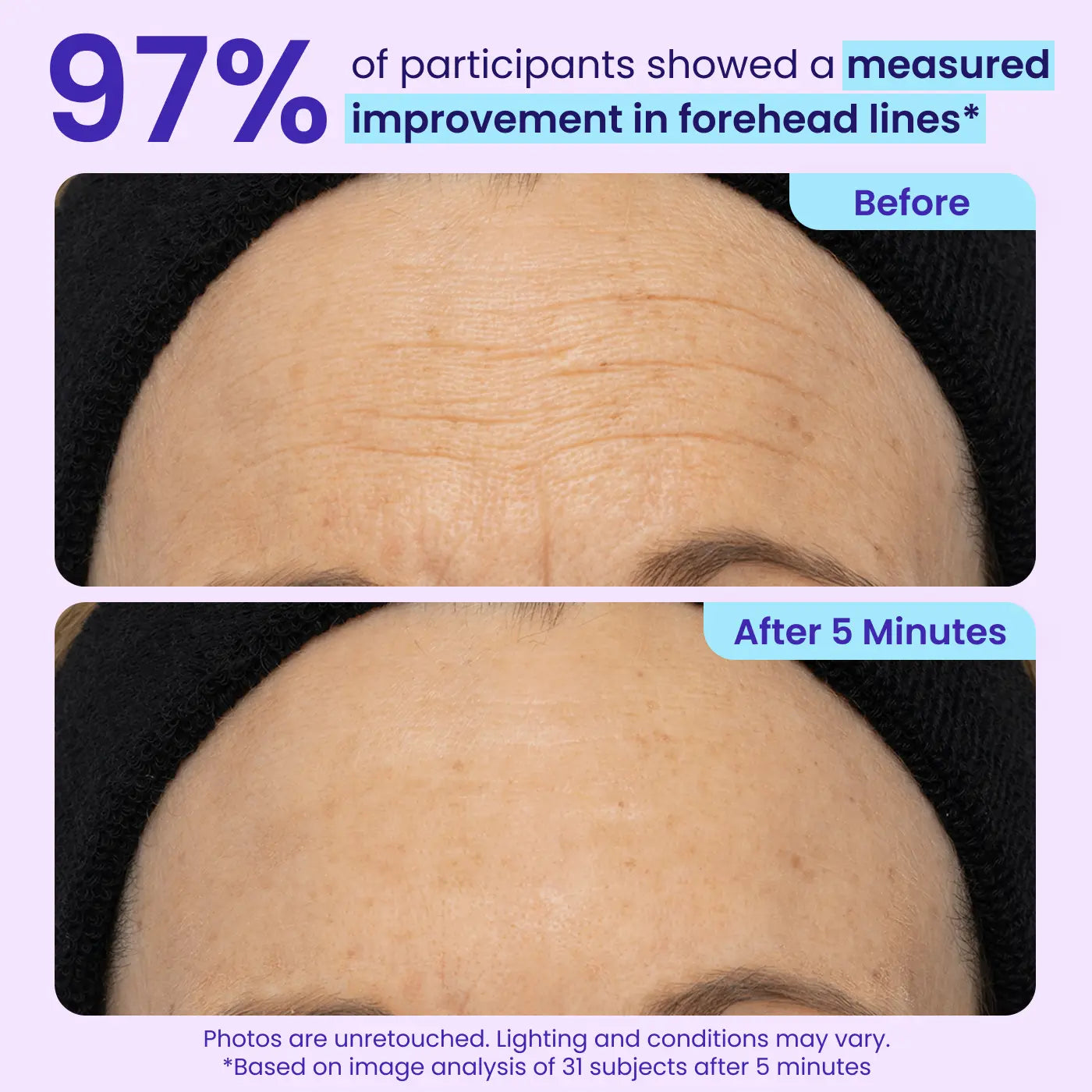 Final Hours: 60% OFF 🔥 SEAGRIL™ Instant Lift Eye Gel for Puffiness, Bags & Dark Circles