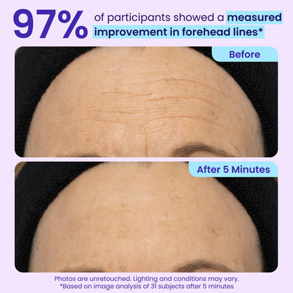 Final Hours: 60% OFF 🔥 SEAGRIL™ Instant Lift Eye Gel for Puffiness, Bags & Dark Circles