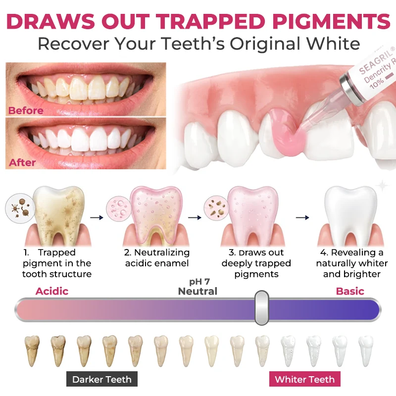 SEAGRIL® DenPerm Cavity-Repair Natural Enamel Filling Gel