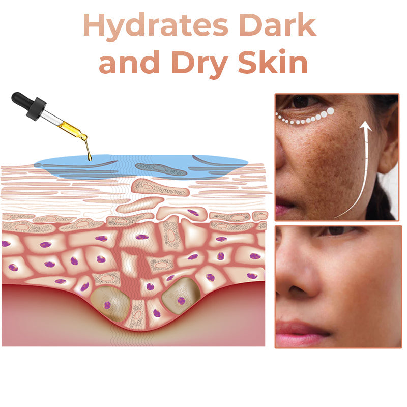 (🔥LAST DAY SALE-70% OFF)-Fast Dark Spot Remover-Tiworld™  Turmeric Spot Repair Serum