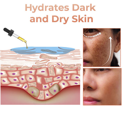(🔥LAST DAY SALE-70% OFF)-Fast Dark Spot Remover-Tiworld™  Turmeric Spot Repair Serum